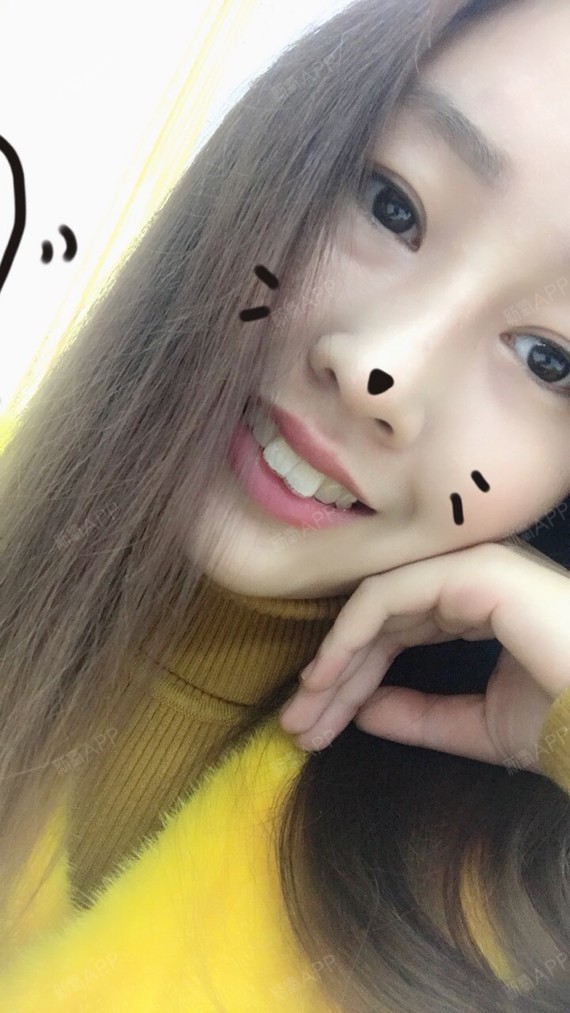 新氧 糯米小团子啊啊啊啊 牙齿 牙齿矫正 牙齿美容 术后当