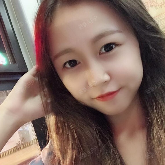 郁卒人1984面部吸脂第25天美丽日记-新氧美容