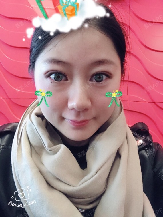 神龙,拍的都是比较近的照片,主要是为了让大家能够看到我大大的眼睛