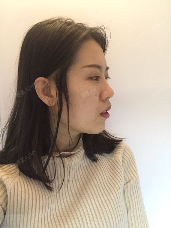 哈哈哈哈哈哈哈哈哈哈哈哈哈,最近一切正常,  下巴自然有点紧绷,跟