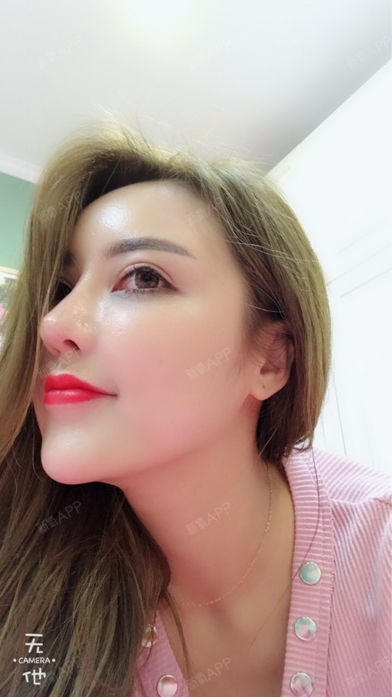 新氧- 泡泡女神 | 私密整形 | 私密紧致 | 手术紧缩阴道 | 激光紧缩
