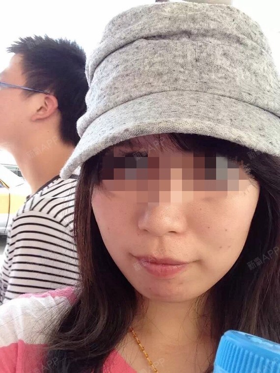 术前脸就是倒梯形,下巴后缩,上颌前突,软组织特别多_圈子-新氧美容