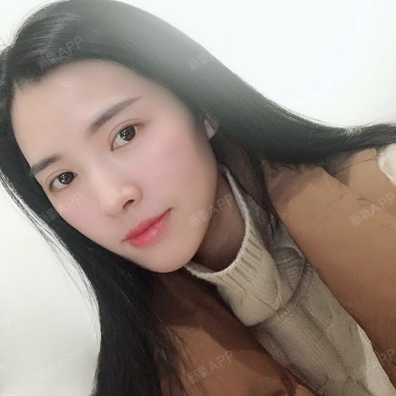 新氧- missliu | 眼部 | 开眼角 | 双眼皮 | 开内眼角 | 开外眼角