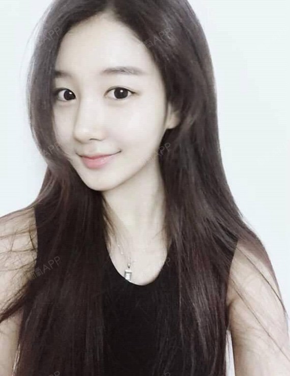 【苏州美贝尔●瘦脸针v脸成型】88天了又来更新了,打了瘦脸针脸部确实