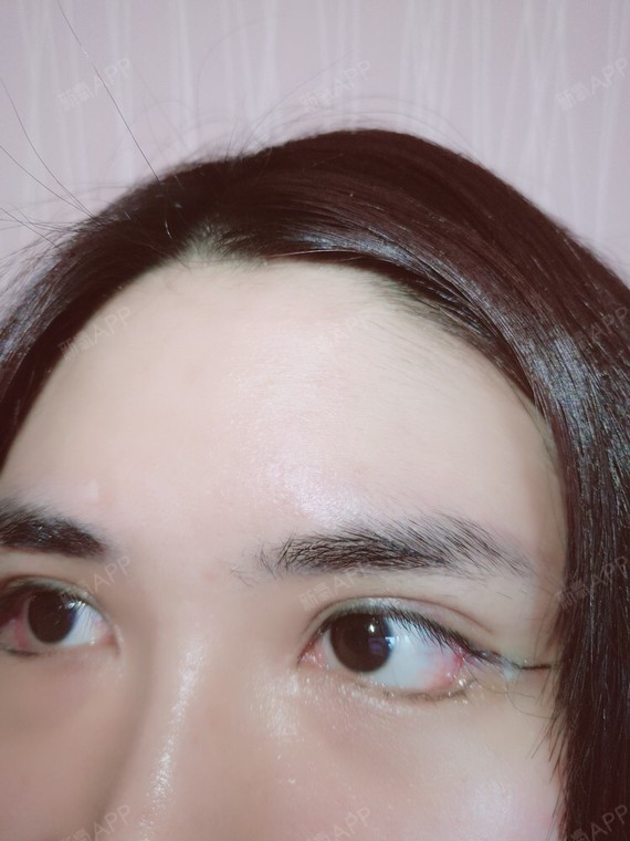 来自欧洲的大美女开外眼角第7天美丽日记