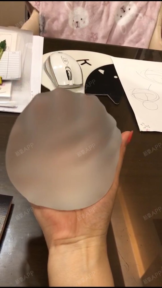 假体隆胸好不好_效果图_安三岁哈假体隆胸术后第0天_新氧美容整形