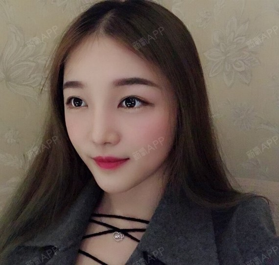 是不是所有的硅胶隆鼻都会出现鼻尖发红现象呢