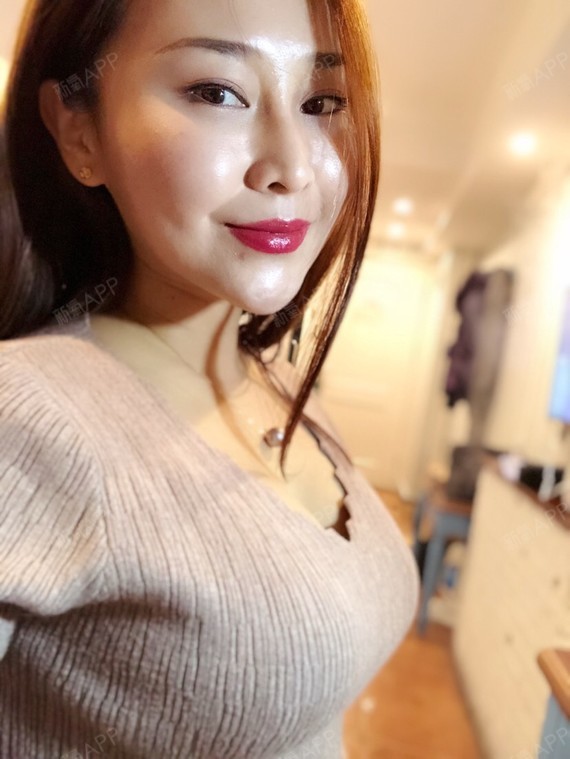 自体脂肪隆胸好不好_效果图_变美达人多多自体脂肪隆胸术后第197天