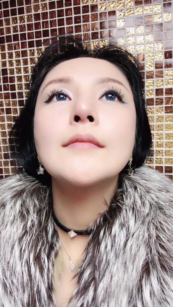 深圳肋软骨隆鼻好不好_效果图_莎莎33肋软骨隆鼻术后第37天_新氧美容