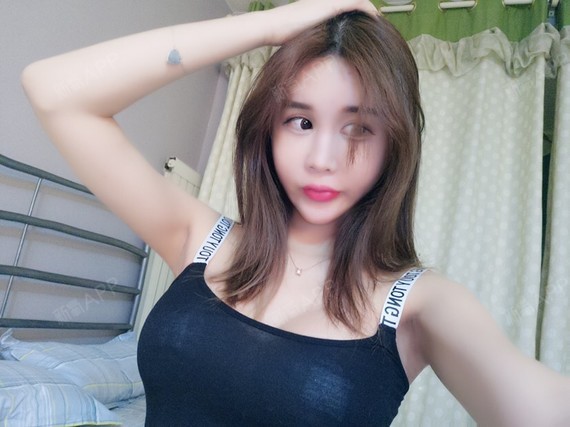 新氧- 张诺浠 | 胸部 | 隆胸 | 假体隆胸 | 术后当自强 | 北京同城