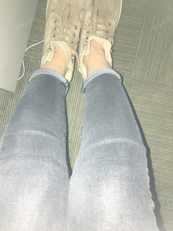 感觉腿肚一点_圈子-新氧美容整形