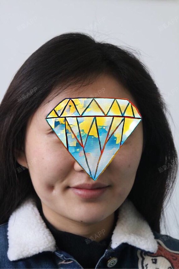 氧气7787011522137762酒窝成形术第120天美丽日记