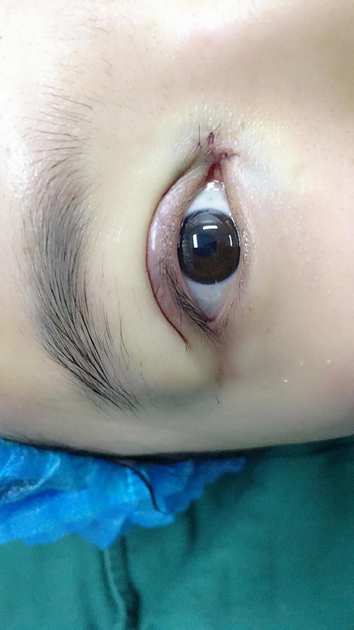 形状我也喜欢,太感谢医生了,谢谢你的细心 3月29日 郑州元素美学整形