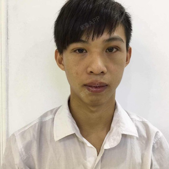 帅哥美女们好啊,很多人觉得说怎么男生还需要整形,其实现在男生整形