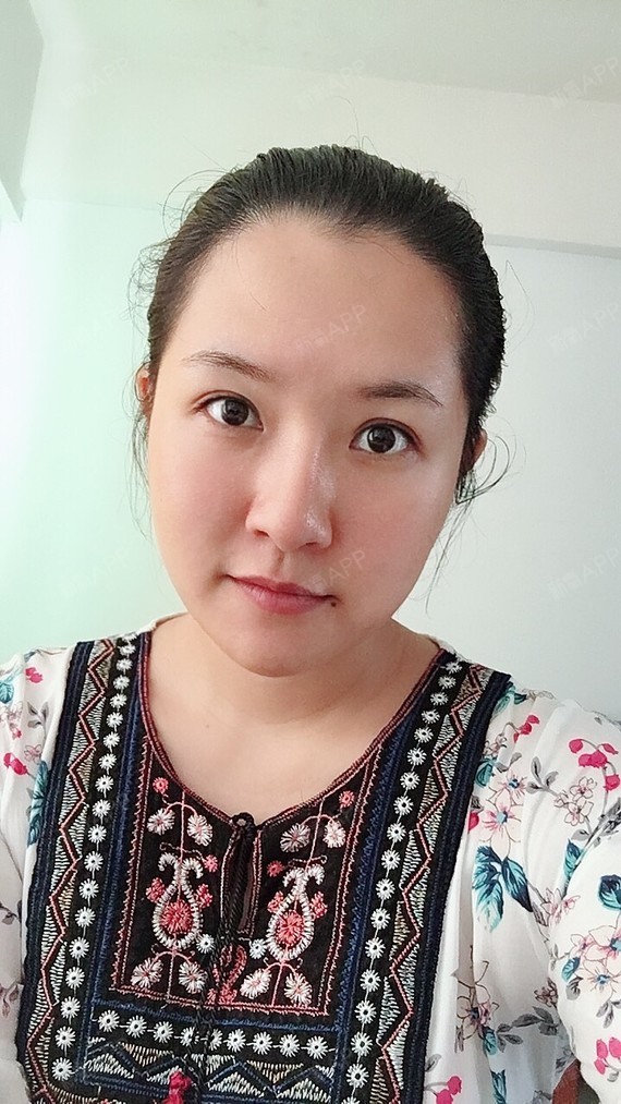 打完瘦脸针第18天,咬牙已经摸不到咬肌了,脸型已经_圈子-新氧美容整形