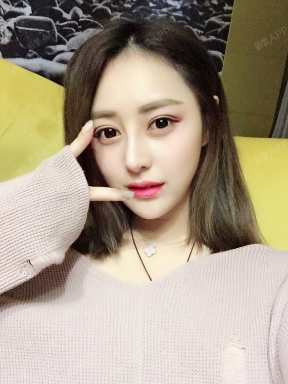 新氧- 氧气0401301501058136 | 鼻部 | 隆鼻 | 鼻头整形 | 膨体隆鼻