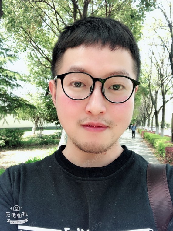 南京美好蔚来 肉毒素除细纹 鱼尾纹