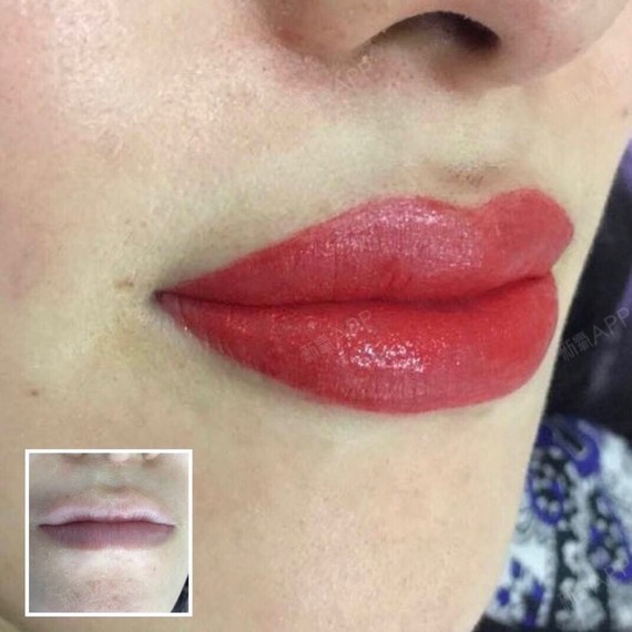 纹唇好不好_效果图_苏格兰1半永久纹唇术后第212天_新氧美容整形