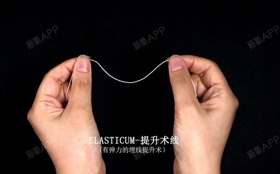 线雕面部提升要多少钱一根线_面部提升做线雕能维持多久_线雕面部提升