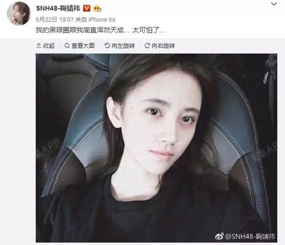 话说,现在的明星都有两幅面孔,第一身份是_圈子-新氧美容整形