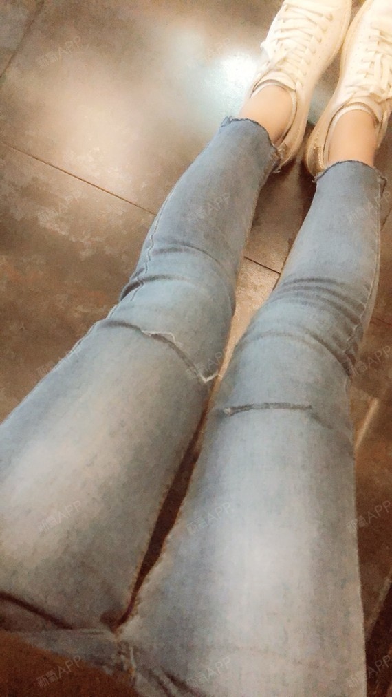 成都冷冻溶脂瘦大腿好不好_效果图_小镇姑娘你冷冻溶脂瘦大腿术后第78