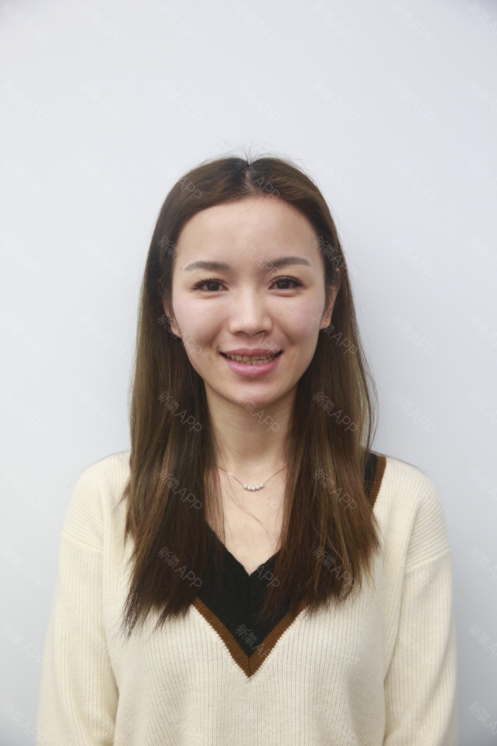 石家庄美莱医学美容医院瓷贴面怎么样_恢复过程_效果如何_小雯文整形