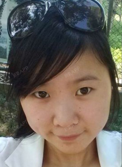 一直都是单眼皮小眼睛,脸还特别圆.