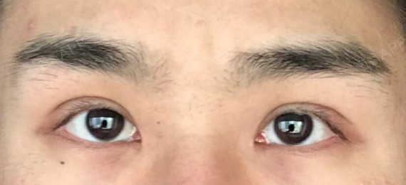 右眼睛感觉好失败 宽 孤独不对 眼角开的少并且起位高