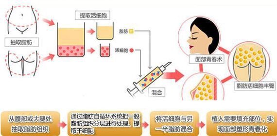 新氧