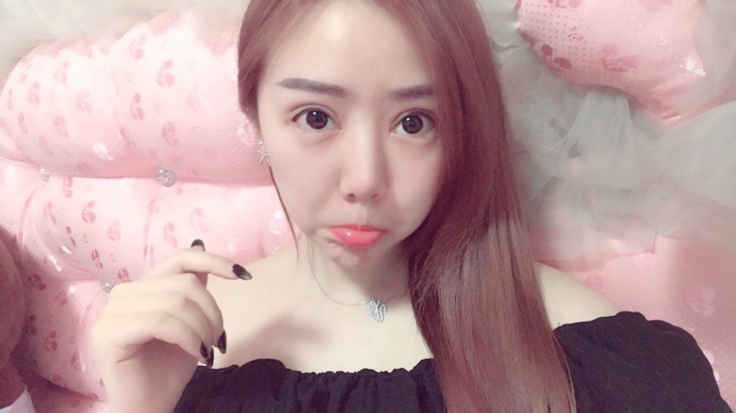 本来_圈子-新氧美容整形