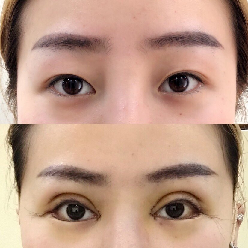 本来_圈子-新氧美容整形