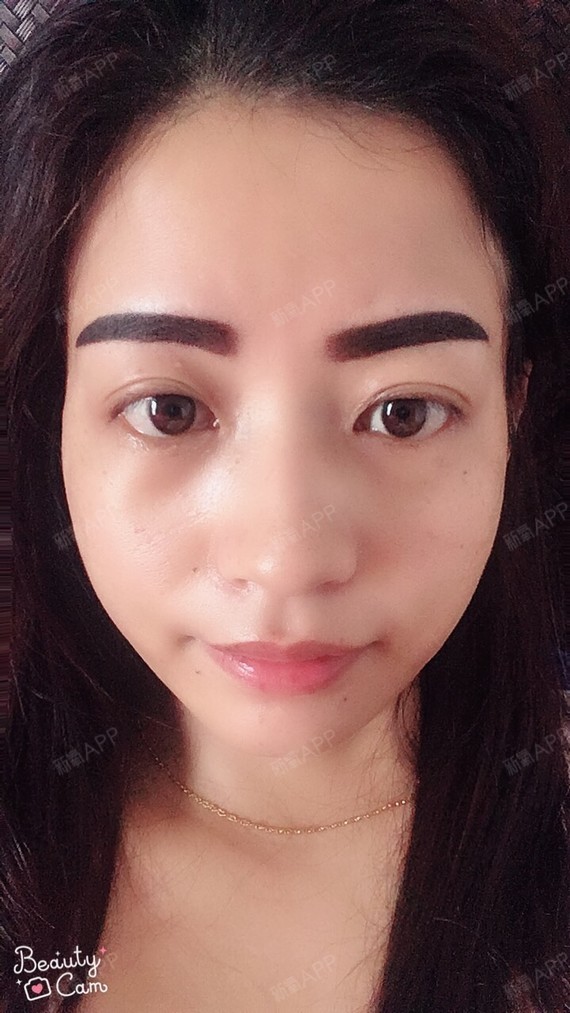 跟昨天一样,没有脱痂,颜色没变.