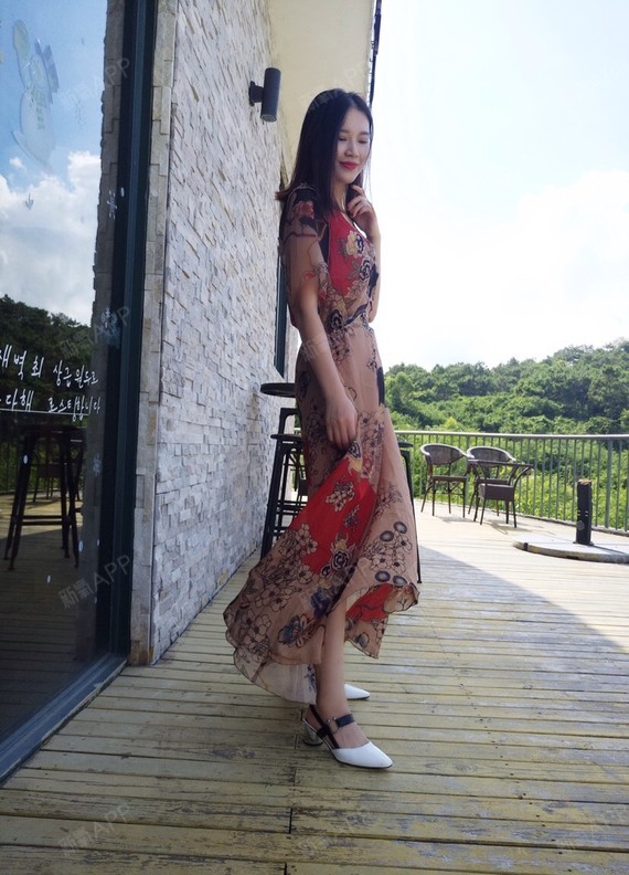 重庆吸脂瘦大腿好不好_效果图_奥尼吸脂瘦大腿术后第98天_新氧美容