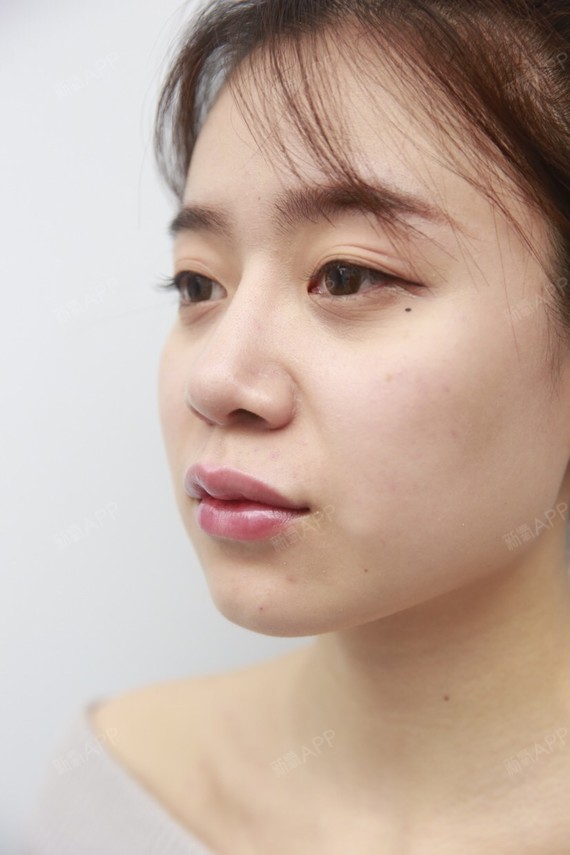 本来我的上嘴唇就有一点薄,唇珠不是很明显,笑起来几乎就成一条线啦