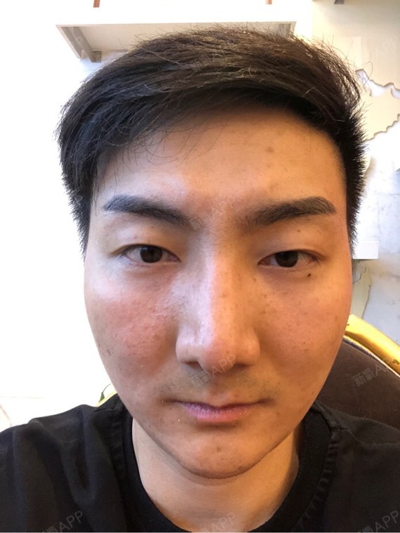 我的鼻子感觉自己过大过长,下巴太短了,所以显的面部不协调