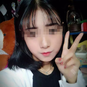 【玻尿酸】伊婉 伊婉c 1ml ,【私信送200元】伊婉c玻尿酸 面部轮廓