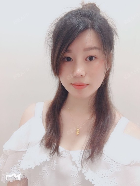 今天快一个半月了,整个脸部和鼻部越显自然,侧面超级_圈子-新氧美容