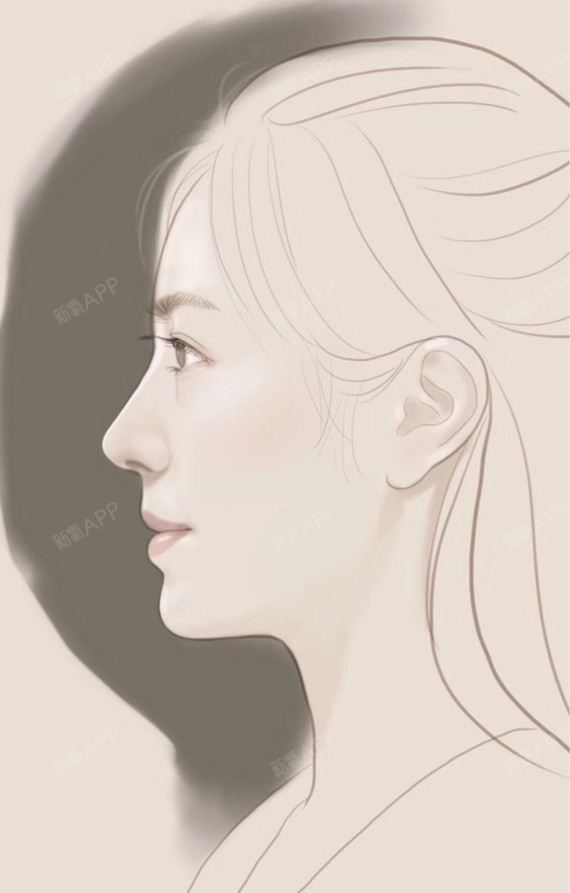 美型设计nana鼻综合第230天美丽日记