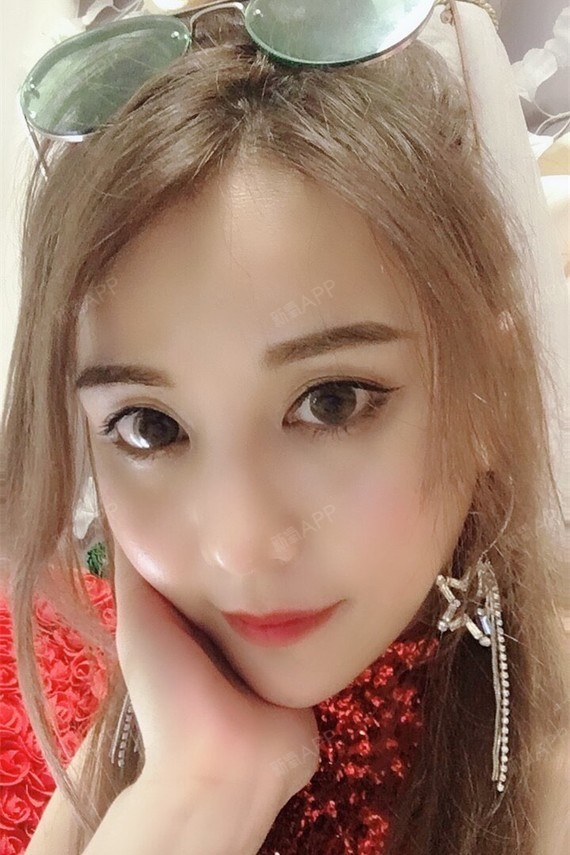 最近瘦了,感觉我的小圆下巴变尖下巴了,但整体看来也_圈子-新氧美容