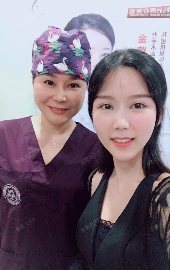 玻尿酸丰太阳穴好不好_效果图_sq_你是谁玻尿酸丰太阳穴术后第115天