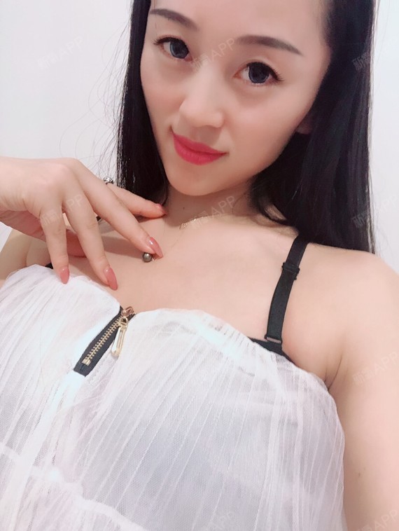 继续和大家分享隆胸后的效果,现在恢复很好,胸部下方_圈子-新氧美容