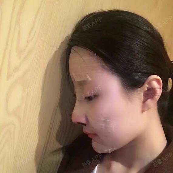 第0天