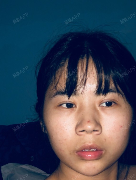 感觉脸型不好看,下巴又短嘴唇又厚,这个脸型从侧面看_圈子-新氧美容