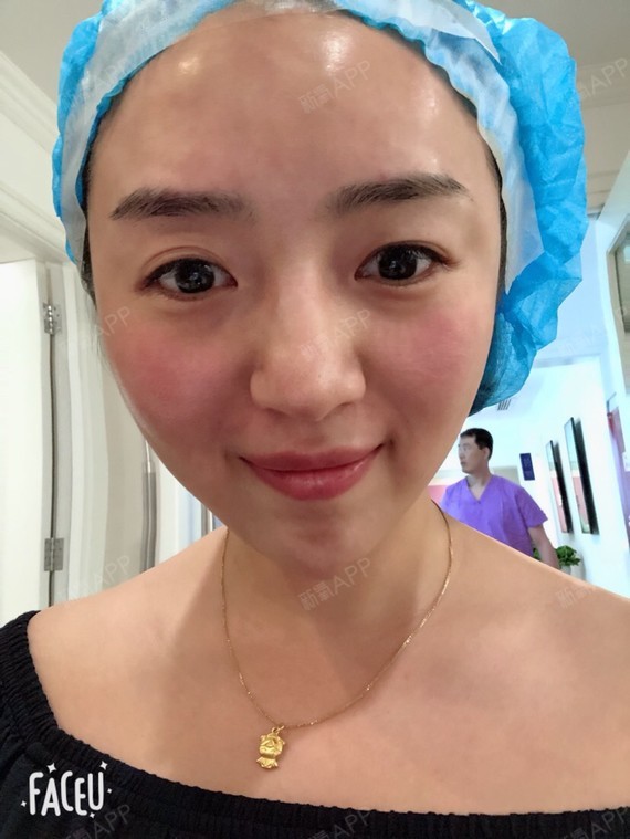 重庆玻尿酸丰额头好不好_效果图_宝宝嘛嘛玻尿酸丰额头术后第0天_新氧