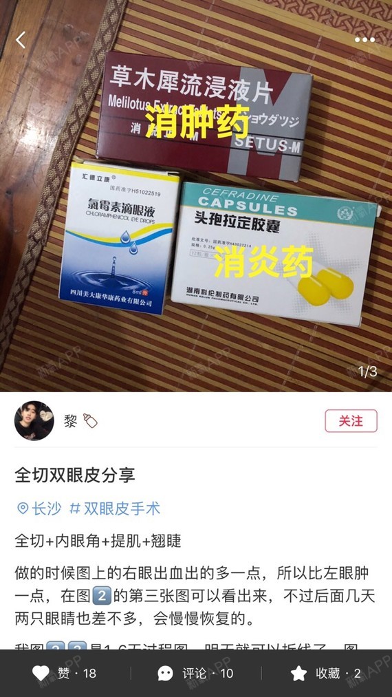 看到好多人推荐这个药草木犀流侵液片可以消肿,我先走一个月了可以买