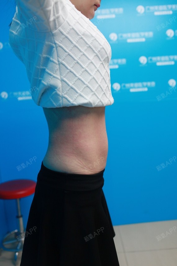 常年脂肪堆积在肉部,我的腹部摸起来不仅肉肉的!