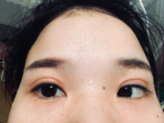 两个月了,正常吗?