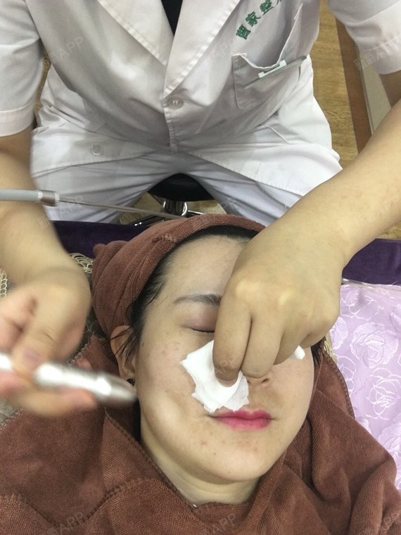 这是做的面部清洁消毒,小妹妹都是学医的,也特别细心