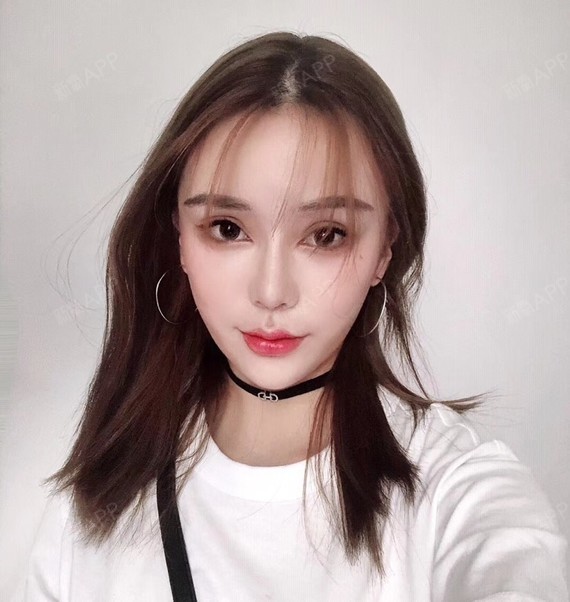 淄博耳软骨复合隆鼻好不好_效果图_小小梨涡耳软骨复合隆鼻术后第59天