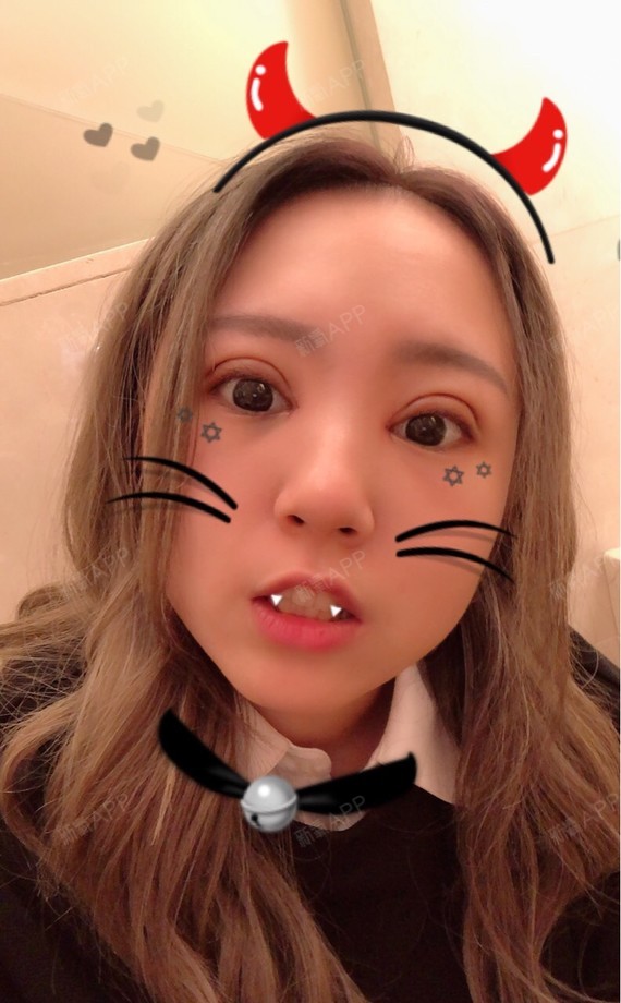 上海切开双眼皮好不好_效果图_伽蓝999切开双眼皮术后第1天_新氧美容